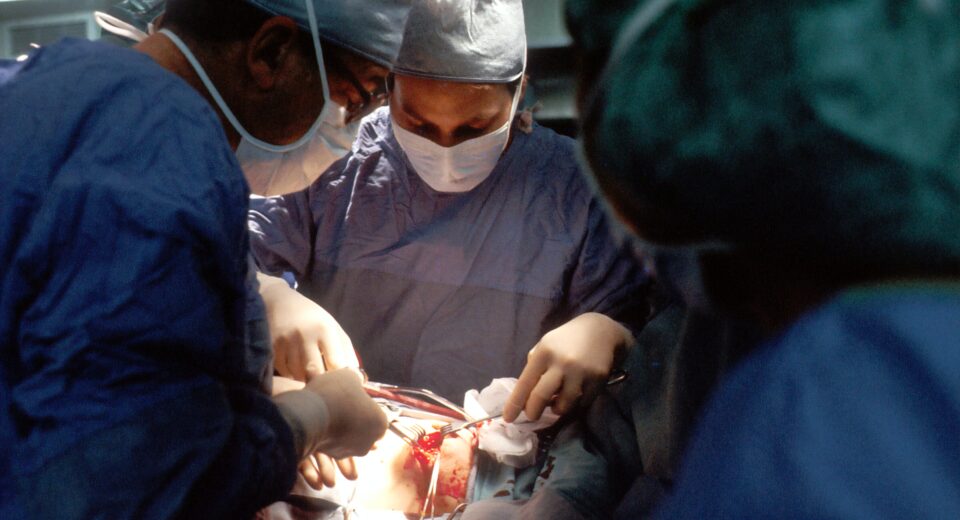 Colon Cancer